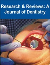 Research and Reviews: A Journal of Dentistry