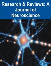 Research and Reviews: A Journal of Neuroscience