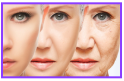 Aging