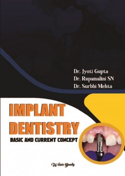 Implant Dentistry