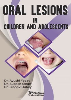 Oral Lesions in Children and Adolescents