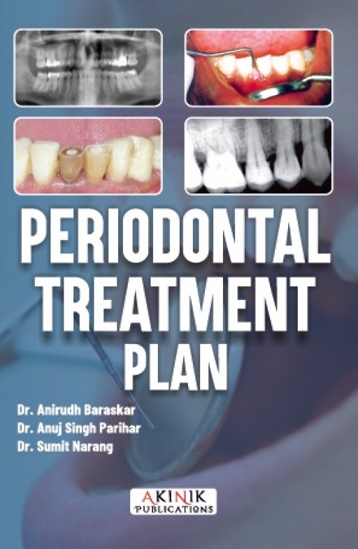 Periodontal Treatment Plan