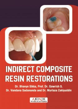 Indirect Composite Resin Restorations