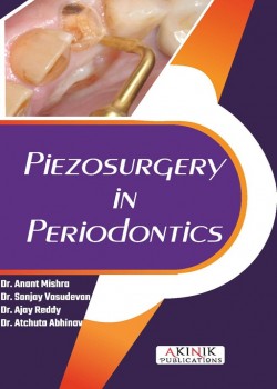 Piezosurgery in Periodontics