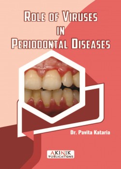 Role of Viruses in Periodontal Diseases