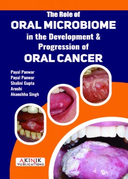 The Role of Oral Microbiome in the Development & Progression of Oral Cancer